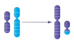 Anomalie chromosomique : Translocation Robertsonienne